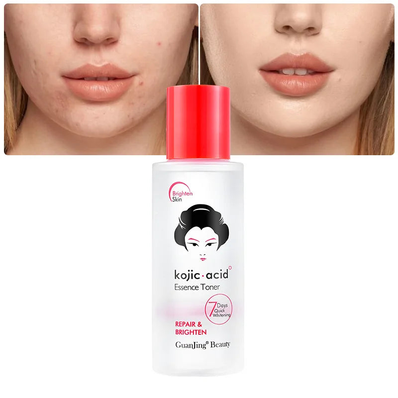 Guanjing Kojic Acid Essence Toner Repair and Brighten